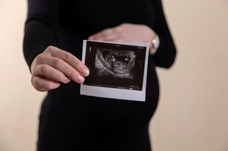 Pregnant Woman Holding Ultrasound